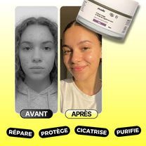 Crème visage à l'huile de nigelle